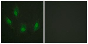 Anti-p53, antibody produced in rabbit affinity isolated antibody
