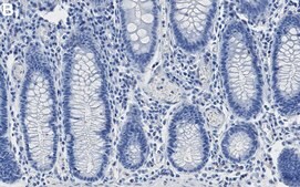 Anti-TOMM20 Antibody, clone 2F8.1 ZooMAb® Mouse Monoclonal recombinant, expressed in HEK 293 cells