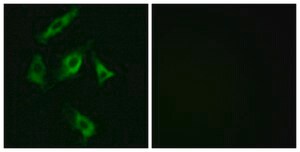 Anti-Stathmin 1 antibody produced in rabbit affinity isolated antibody