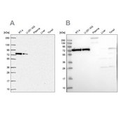 Anti-XRCC6 antibody produced in rabbit Prestige Antibodies® Powered by Atlas Antibodies, affinity isolated antibody, buffered aqueous glycerol solution