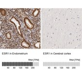 抗-ESR1 兔抗 Prestige Antibodies® Powered by Atlas Antibodies, affinity isolated antibody, buffered aqueous glycerol solution
