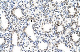 Anti-PRMT5 antibody produced in rabbit IgG fraction of antiserum