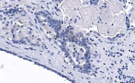 Anti-phospho-eIF-2α-Ser51 Antibody, clone 4N22 ZooMAb® Rabbit Monoclonal recombinant, expressed in HEK 293 cells