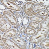 Anti- Calreticulin antibody produced in rabbit