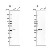 Anti-MS4A1 antibody produced in rabbit Prestige Antibodies® Powered by Atlas Antibodies, affinity isolated antibody, buffered aqueous glycerol solution