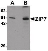Anti-ZIP7 antibody produced in rabbit affinity isolated antibody