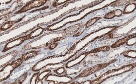 Anti-Aconitase 2/ACO2 Antibody, clone 1D15 ZooMAb® Rabbit Monoclonal recombinant, expressed in HEK 293 cells