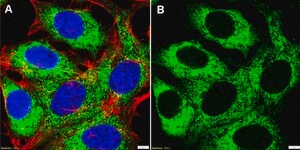 Anti-RPS3 Antibody, clone 3I17 ZooMAb® Rabbit Monoclonal recombinant, expressed in HEK 293 cells