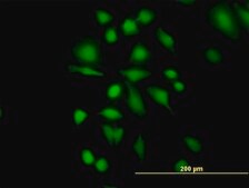 Anti-ETHE1 antibody produced in mouse IgG fraction of antiserum, buffered aqueous solution