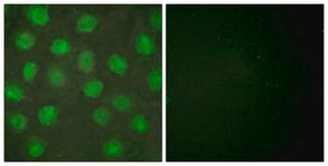 Anti-Retinoid X Receptor γ antibody produced in rabbit affinity isolated antibody