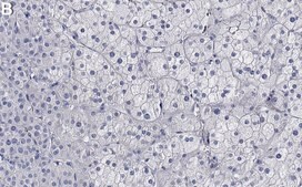 Anti-StAR Antibody, clone 1G15 ZooMAb® Rabbit Monoclonal recombinant, expressed in HEK 293 cells