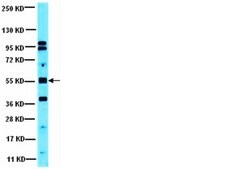 Anti-PP2A Antibody, B β subunit from rabbit, purified by affinity chromatography