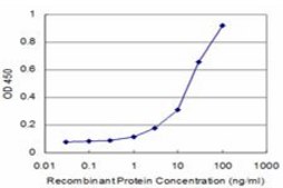 Monoclonal Anti-CSF1 antibody produced in mouse clone 1A9, purified immunoglobulin, buffered aqueous solution