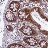 Anti-CLINT1 antibody produced in rabbit Prestige Antibodies® Powered by Atlas Antibodies, affinity isolated antibody, buffered aqueous glycerol solution