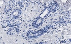 Anti-IGF-1R β Antibody, clone 1D18 ZooMAb® Rabbit Monoclonal recombinant, expressed in HEK 293 cells