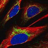 Anti-ACOT1 antibody produced in rabbit Prestige Antibodies® Powered by Atlas Antibodies, affinity isolated antibody, buffered aqueous glycerol solution
