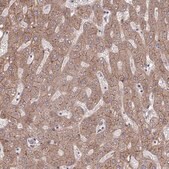 Anti-ITPR2 antibody produced in rabbit Prestige Antibodies® Powered by Atlas Antibodies, affinity isolated antibody, buffered aqueous glycerol solution