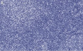 Anti-Caspase-1 p10 Antibody, clone 9H11 ZooMAb® Rabbit Monoclonal recombinant, expressed in HEK 293 cells