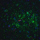 Anti-Bcl-2 (ab1) antibody produced in rabbit affinity isolated antibody, buffered aqueous solution
