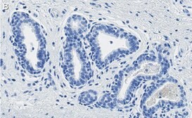 Anti-PTEN Antibody, clone 6B12 ZooMAb® Rabbit Monoclonal recombinant, expressed in HEK 293 cells