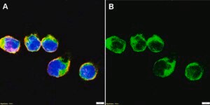 Anti-PLCG2 Antibody, clone 1L6 ZooMAb® Rabbit Monoclonal recombinant, expressed in HEK 293 cells