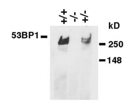 Anti-53BP1 Antibody, clone BP18 ascites fluid, clone BP18, Chemicon&#174;