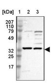 Anti-SLC25A21 antibody produced in rabbit Prestige Antibodies® Powered by Atlas Antibodies, affinity isolated antibody, buffered aqueous glycerol solution