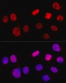 Anti-p53 antibody produced in rabbit
