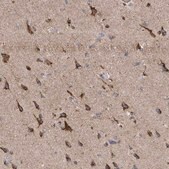 Anti-ITM2B antibody produced in rabbit Prestige Antibodies® Powered by Atlas Antibodies, affinity isolated antibody, buffered aqueous glycerol solution