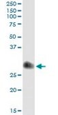 Monoclonal Anti-TIMP1 antibody produced in mouse clone 4D12, purified immunoglobulin, buffered aqueous solution