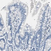 Anti-CA1 antibody produced in rabbit Prestige Antibodies® Powered by Atlas Antibodies, affinity isolated antibody, buffered aqueous glycerol solution