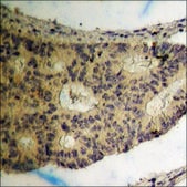 抗 磷酸化 hnRNP K (pSer 284 ) 兔抗 affinity isolated antibody