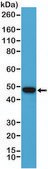 Anti-PAX-5 (paired box protein) antibody, Rabbit monoclonal recombinant, expressed in HEK 293 cells, clone RM331, purified immunoglobulin