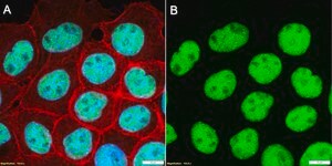 Anti-CBX3/HP1γ Antibody, clone 1K5 ZooMAb® Rabbit Monoclonal recombinant, expressed in HEK 293 cells