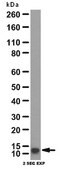 Anti-Fibroblast-specific Protein 1 (S100A4) Antibody from rabbit, purified by affinity chromatography