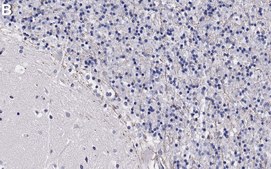 Anti-GABRB2 Antibody, clone BD17 ZooMAb® Mouse Monoclonal recombinant, expressed in HEK 293 cells