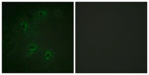 Anti-DAPK1 antibody produced in rabbit affinity isolated antibody