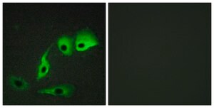 Anti-Calmodulin antibody produced in rabbit affinity isolated antibody
