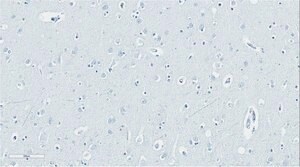 Anti-ApoE4 Fragment nApoECF Antibody (Asp172) from rabbit, purified by affinity chromatography