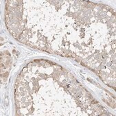 Anti-ETHE1 antibody produced in rabbit Prestige Antibodies® Powered by Atlas Antibodies, affinity isolated antibody, buffered aqueous glycerol solution, ab2