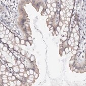 Anti-DOPEY1 antibody produced in rabbit Prestige Antibodies® Powered by Atlas Antibodies, affinity isolated antibody, buffered aqueous glycerol solution, ab1