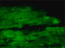 Anti-Desmin antibody produced in rabbit whole antiserum