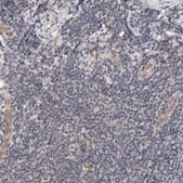Anti-LAMB1 antibody produced in rabbit Prestige Antibodies® Powered by Atlas Antibodies, affinity isolated antibody, buffered aqueous glycerol solution