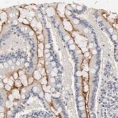Anti-SLC10A2 antibody produced in rabbit Prestige Antibodies® Powered by Atlas Antibodies, affinity isolated antibody, buffered aqueous glycerol solution