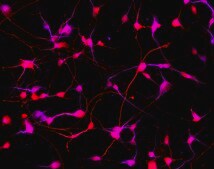 Human Striatal Medium Spiny GABAergic Neurons Human iPSC line, Fully differentiated, Healthy Male Control (no known neurological disorders), Cryopreserved