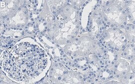 Anti-ASS1 Antibody, clone 2E22 ZooMAb® Rabbit Monoclonal recombinant, expressed in HEK 293 cells