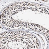 Anti-PDCD6IP antibody produced in rabbit Prestige Antibodies® Powered by Atlas Antibodies, affinity isolated antibody, buffered aqueous glycerol solution