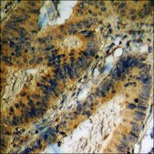 Anti-phospho-CXCR4 (pSer339) antibody produced in rabbit affinity isolated antibody