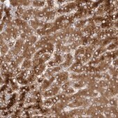 Anti-ALDH1L1 antibody produced in rabbit Prestige Antibodies® Powered by Atlas Antibodies, affinity isolated antibody, buffered aqueous glycerol solution