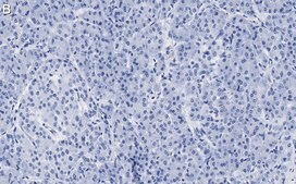 Anti-PGP9.5/UCHL1 Antibody, clone 3C13 ZooMAb® Rabbit Monoclonal recombinant, expressed in HEK 293 cells